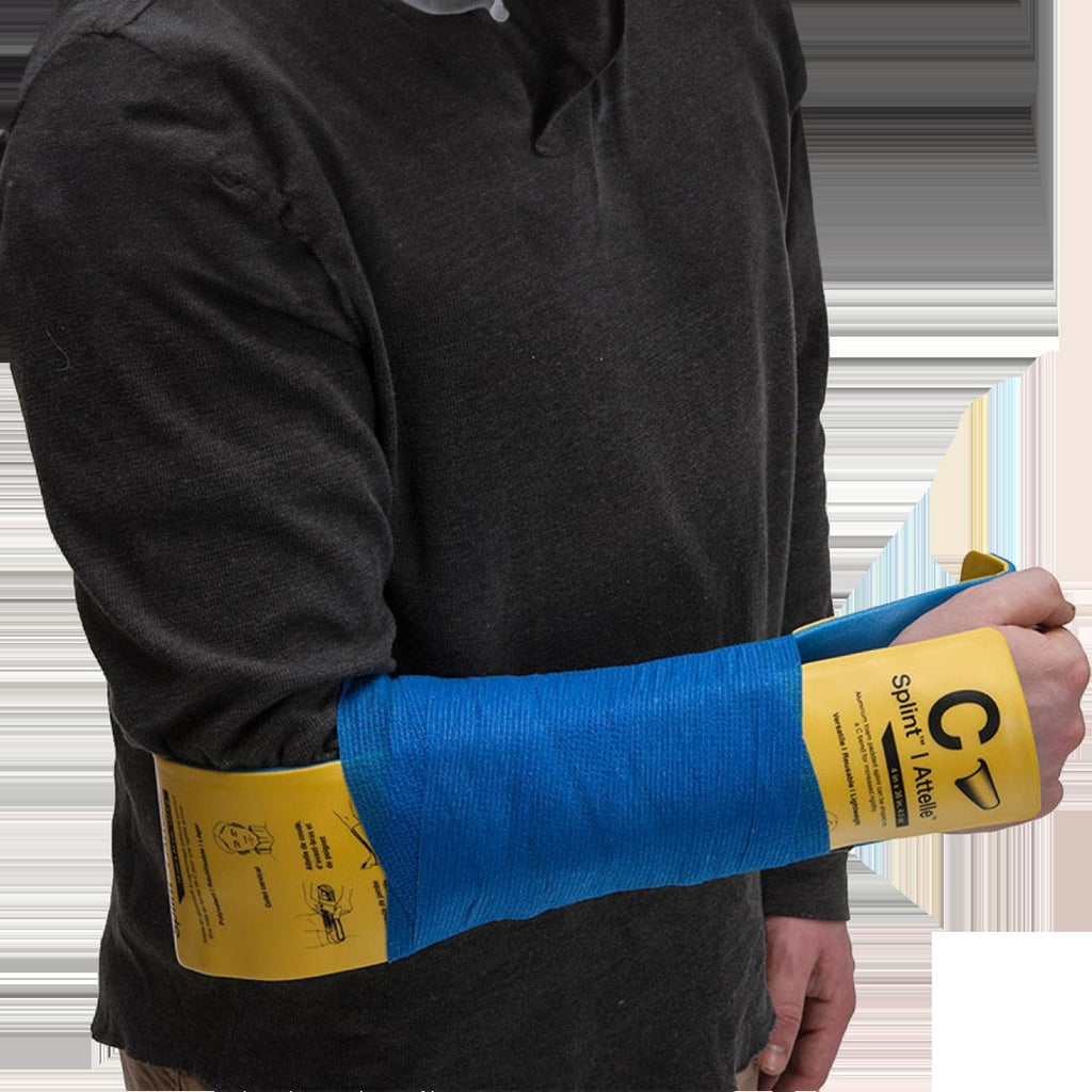 C-Splint